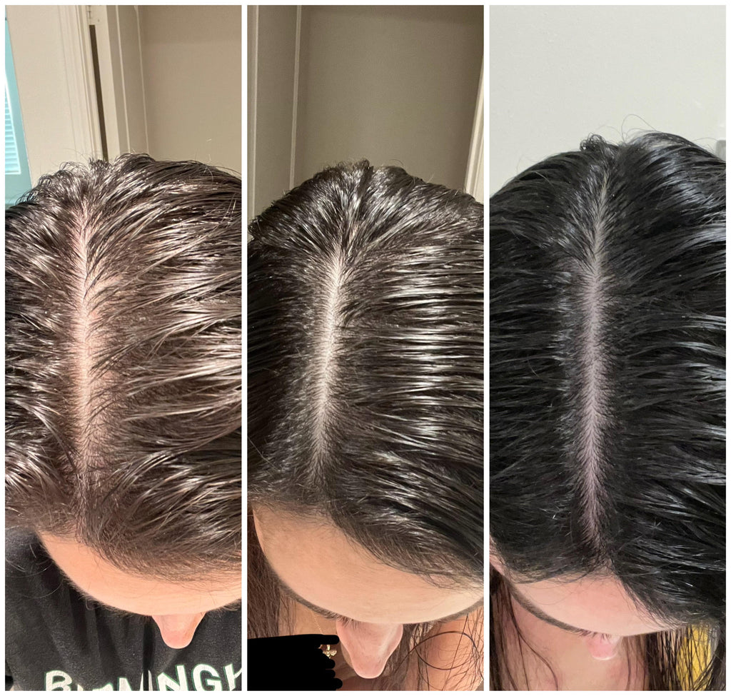 Red Light Therapy Hat for Hair Regrowth Treatments