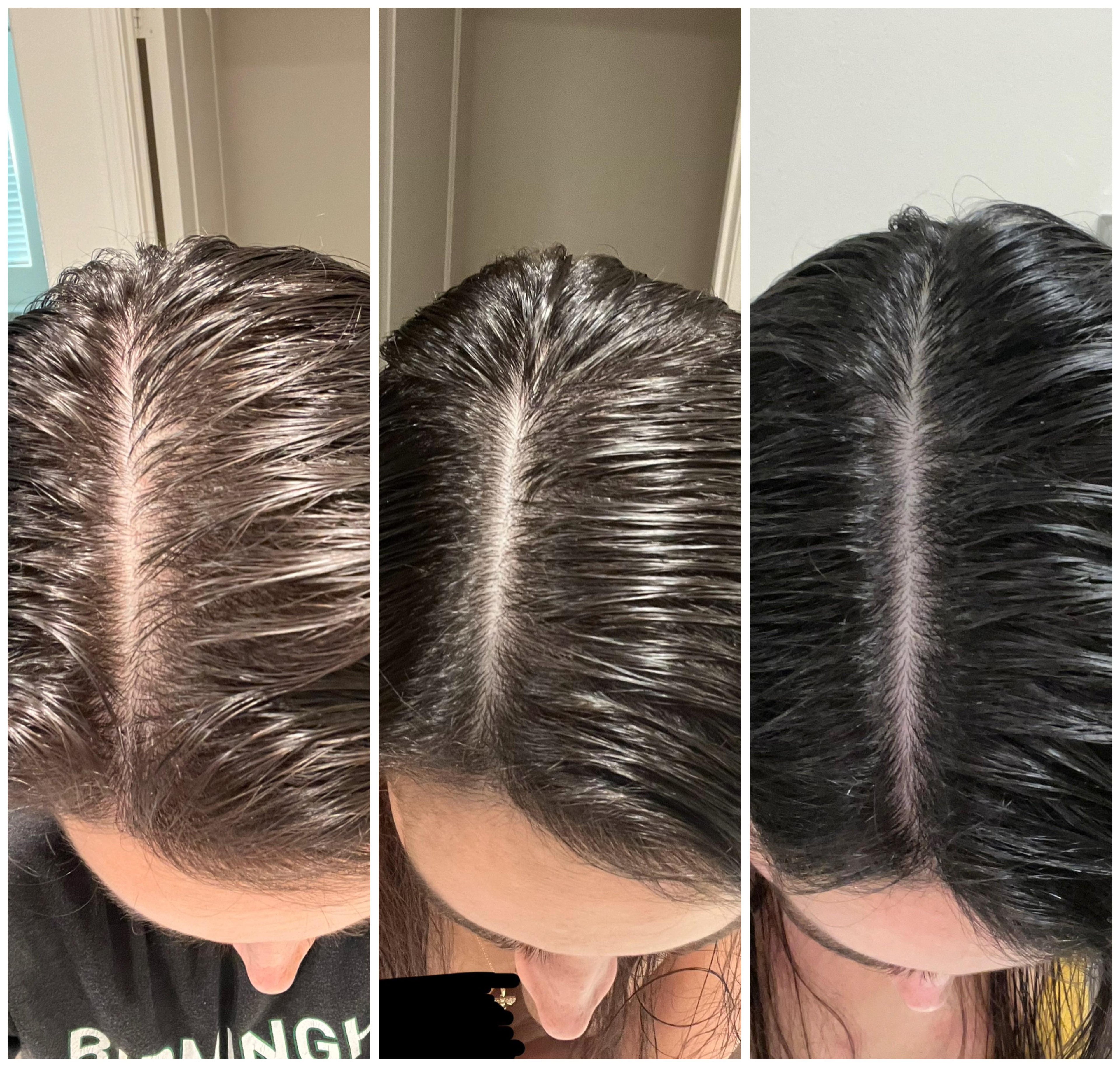 Red Light Therapy Hat for Hair Regrowth Treatments